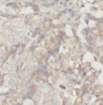 PACSIN2 Antibody