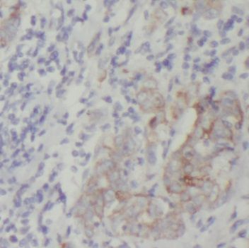 PACSIN3 Antibody