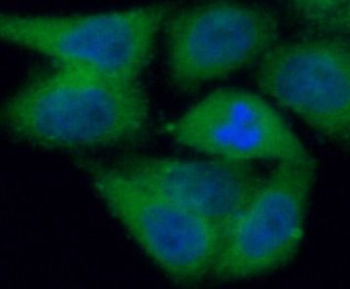 PADI2 Antibody