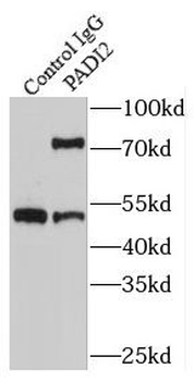 PADI2 Antibody