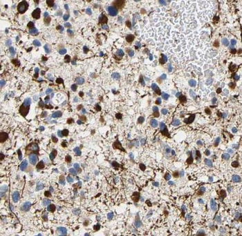 PADI2 Antibody