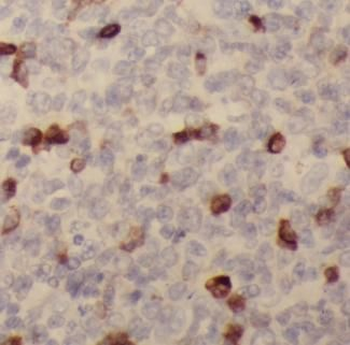 PADI4 Antibody