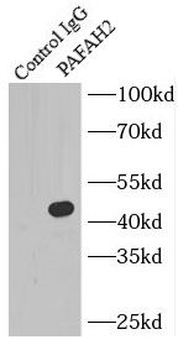 PAFAH2 Antibody