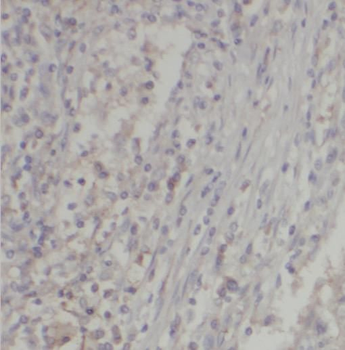 SERPINE1 Antibody