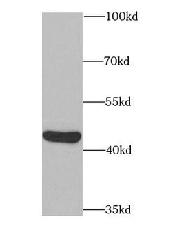 PAICS Antibody