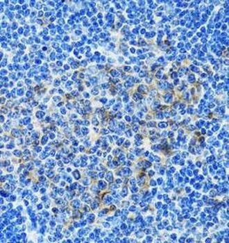 PAICS Antibody