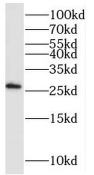 PAIP2 Antibody