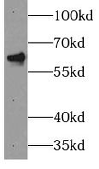 PAK4 Antibody