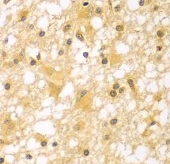 PAK6 Antibody