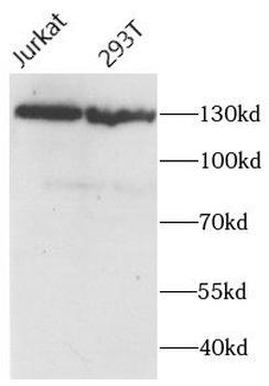 PALB2 Antibody