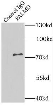 PALMD Antibody