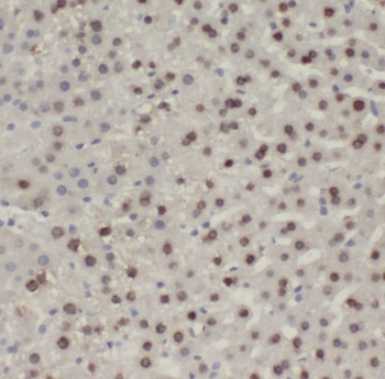 PALMD Antibody