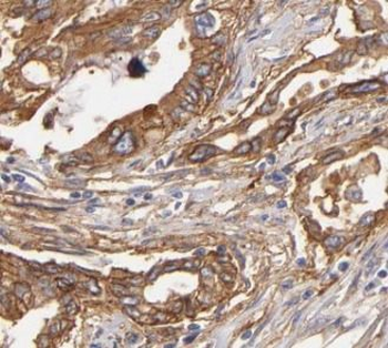 PNLIP Antibody