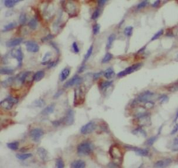 PANK2 Antibody