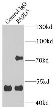 TENT4B Antibody
