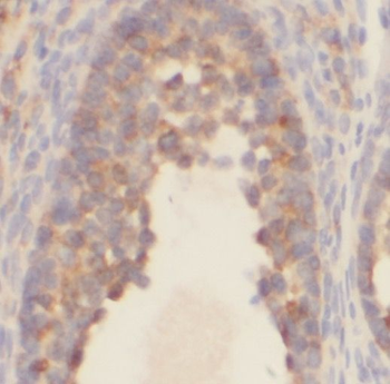 PAPSS1 Antibody