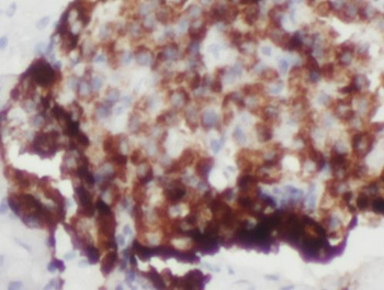 PARD6B Antibody