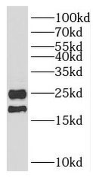 PARK7 Rabbit Polyclonal Antibody