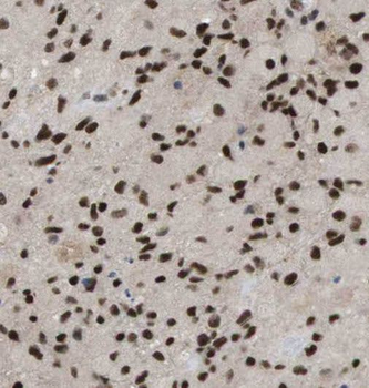 PARK7 Rabbit Polyclonal Antibody