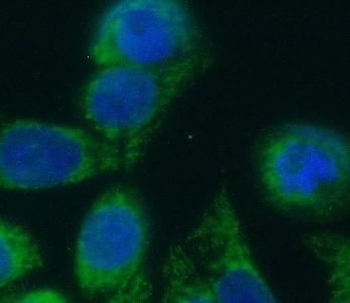 PRKN Rabbit Polyclonal Antibody
