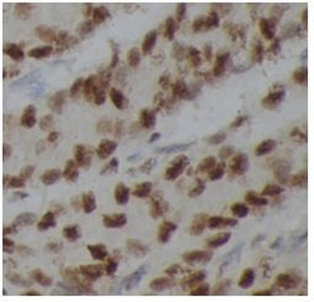 PARP1 Antibody