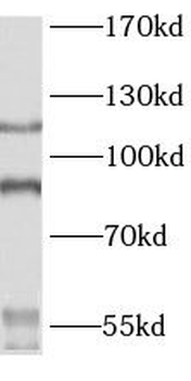 PARP1 Antibody