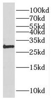 PARP11 Antibody