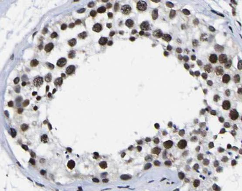 PARP11 Antibody