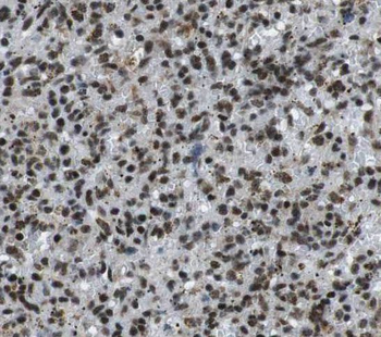 PARP9 Antibody