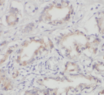 PARVA Antibody