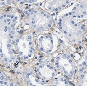 PARVA Antibody
