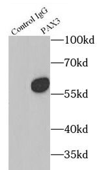 PAX3 Antibody