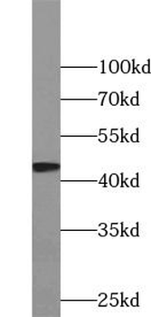 PAX6 Rabbit Polyclonal Antibody