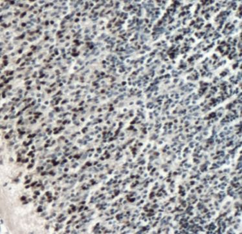 PAX6 Rabbit Polyclonal Antibody
