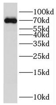 PBX4 Rabbit Polyclonal Antibody