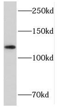 CDH3 Antibody