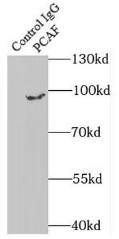 KAT2B Antibody