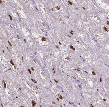 KAT2B Antibody