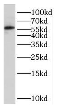 PCCB Antibody