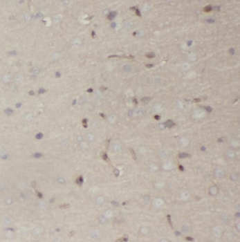 PCDH11X Antibody