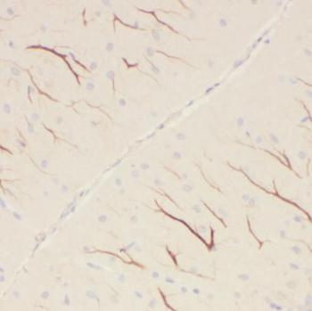 PCDHA5 Antibody