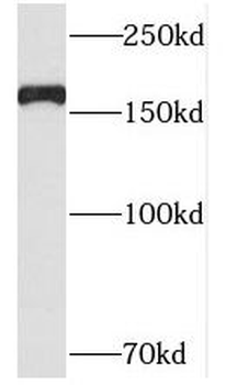 PCF11 Rabbit Polyclonal Antibody