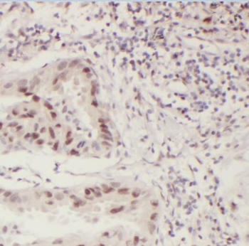 PCIF1 Antibody