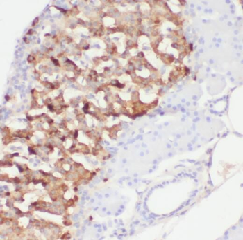 PCMT1 Antibody