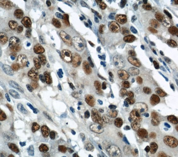 PCNA Antibody