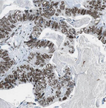 PCNA Antibody
