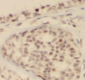 PCNA Antibody