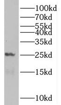 PCNP Antibody
