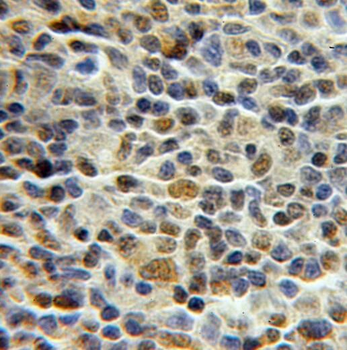 PCNP Antibody