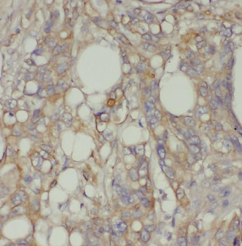 PCSK7 Antibody